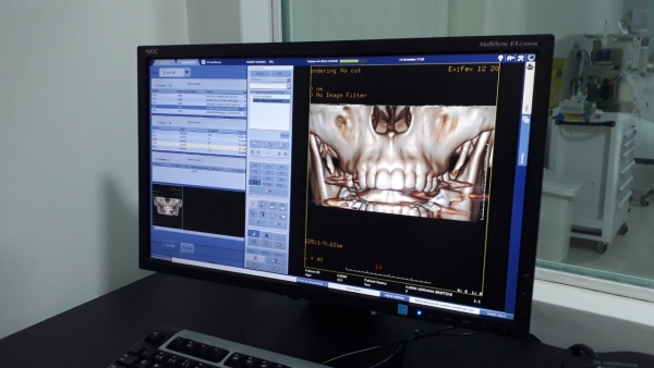 NOVO EXAME: Tomografia Computadorizada DENTAL SCAN